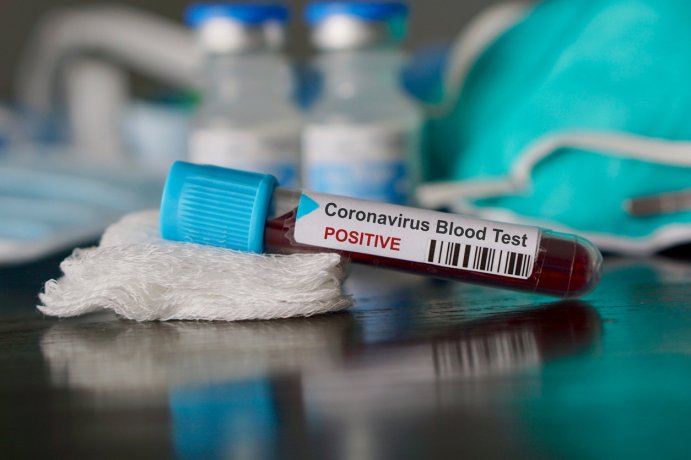 En cas de réinfection, développe-t-on une forme plus grave du coronavirus ?