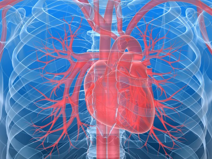 L’infarctus du myocarde, le résultat de l’obstruction des artères du cœur