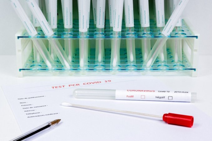 Test PCR : quand le passer ?