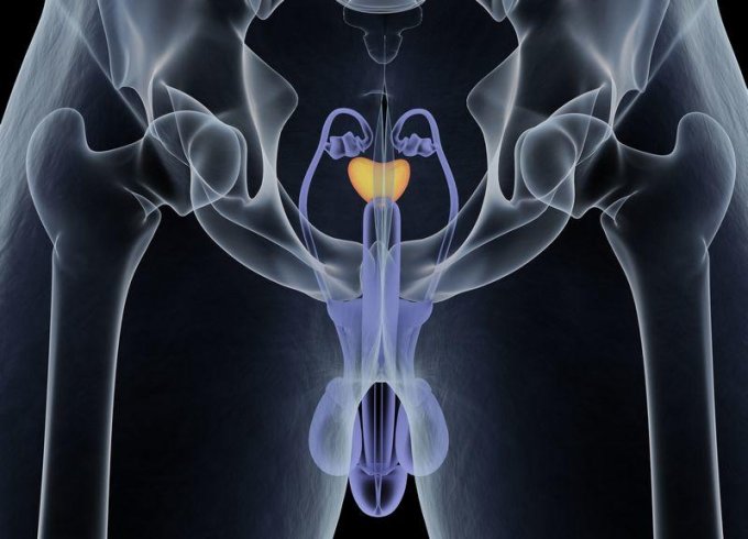 Se faire masser la prostate pour éviter la prostatite chronique