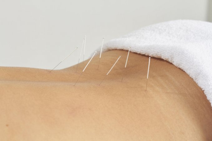 Hernies discales : l'acupuncture et l'ost&eacute;opathie sont-elles efficaces ?