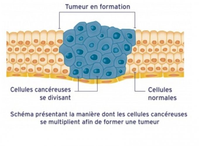 Comment se forme une tumeur ?
