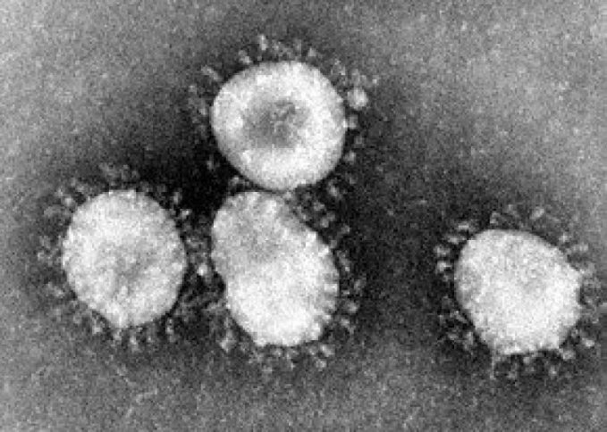 Photo : virions de virus SARS-CoV (coronavirus)