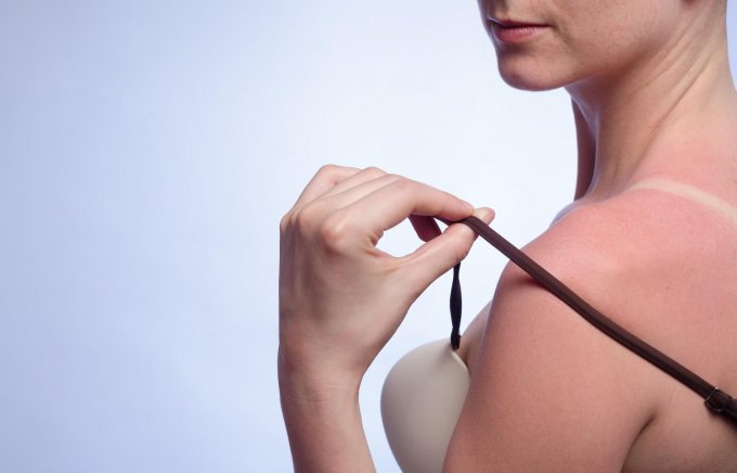 Des médicaments contre l&apos;hypertension pourraient augmenter le risque de cancer de la peau