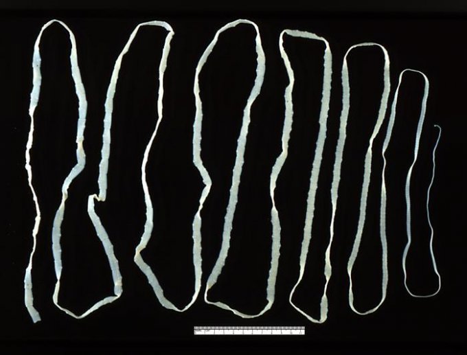 Le taenia saginata (ténia inerme) :