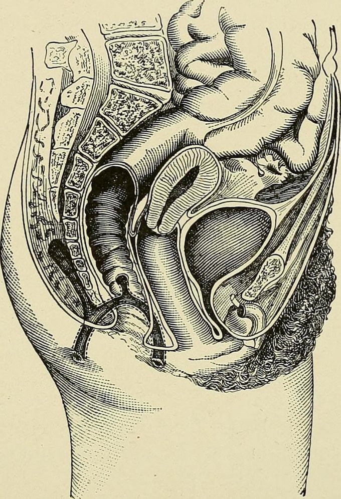 Les causes de la fistule anale