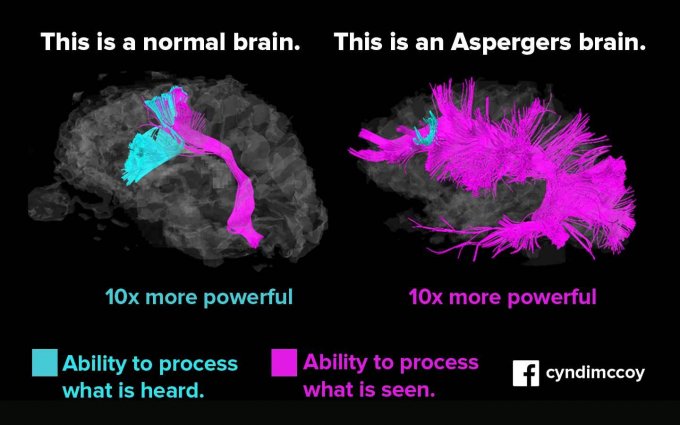 Qu&apos;est-ce que le syndrome d’Asperger et les TSAsdi ?