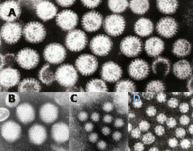 Photo : Différents virus de la gastro-entérite ; A = rotavirus ; B = adenovirus ; C = Norovirus, D = Astrovirus