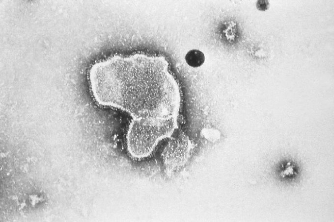 Photo : virus respiratoire syncytial au microscope électronique 