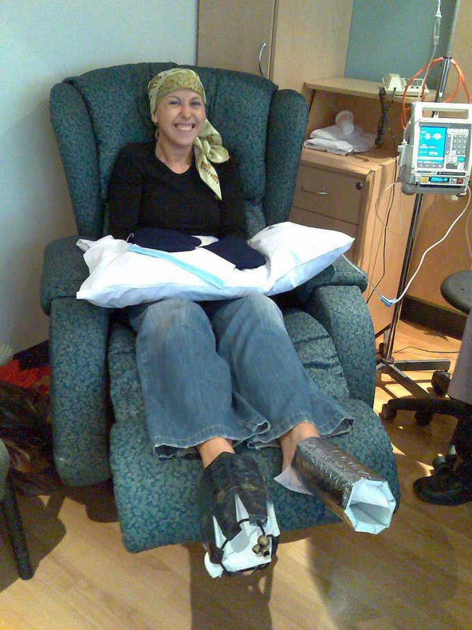 Photo : femme recevant une chimiothérapie, portant un système de refroidissement pour protéger ses ongles