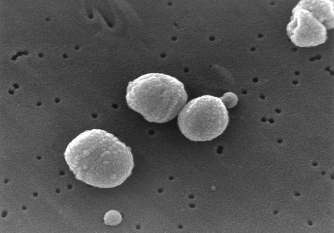 Photo : bactéries streptococcus pneumoniae (pneumocoques)