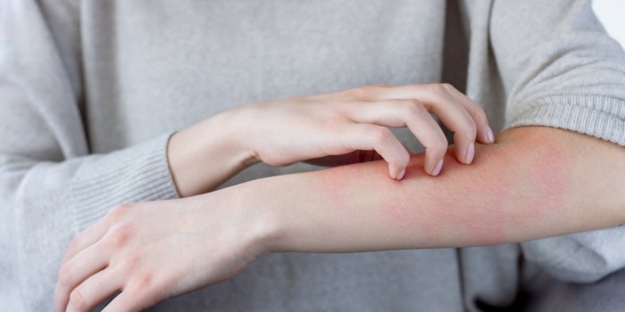 Bracelets anti-moustiques : 4 dangers à connaître