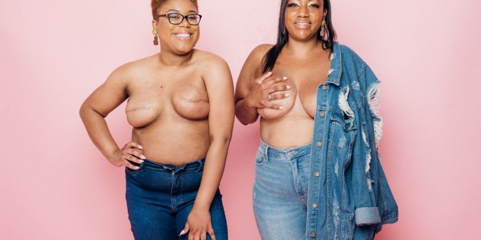 Cancer du sein : des femmes de couleur se déshabillent pour rappeler qu'elles existent