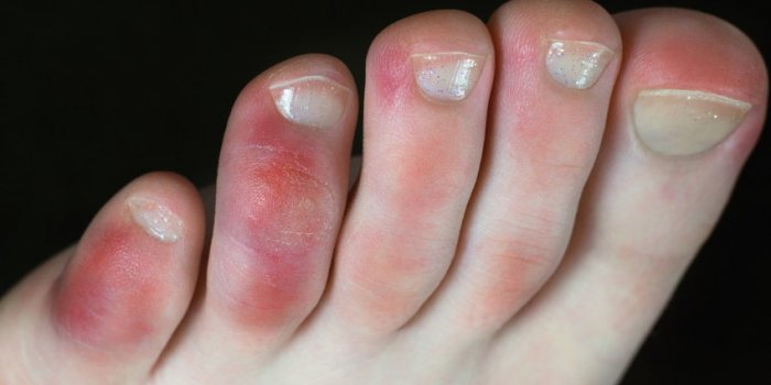 Maladies : 10 signes révélateurs sur vos pieds 