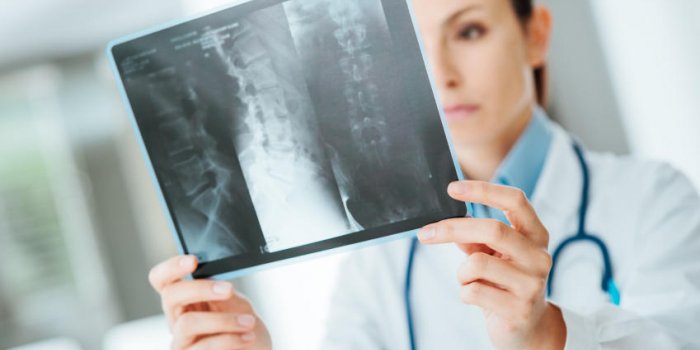 jeune femme mÃ©decin examinant la radiographie de la colonne vertÃ©brale d'un patient lors d'une visite