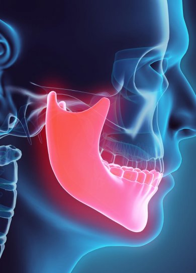 Extraction de dent(s) : Quelles peuvent Ãªtre les complications ?