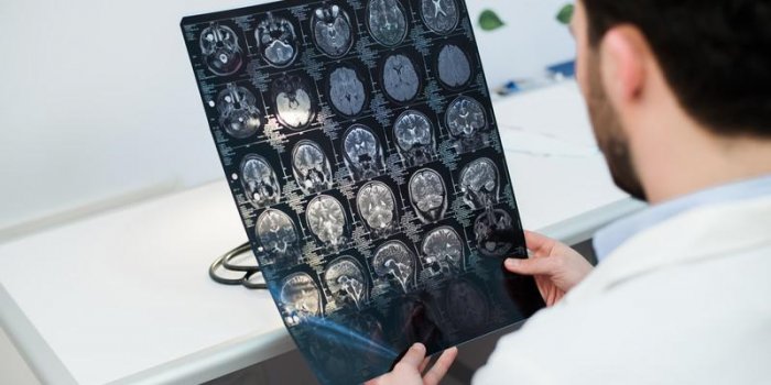jeune homme médecin lisant et examinant un scanner cérébral irm