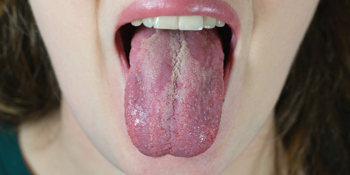 DiabÃ¨te : 5 signes Ã  repÃ©rer dans votre bouche