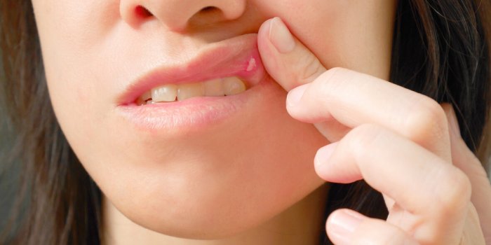 DiabÃ¨te : 5 signes Ã  repÃ©rer dans votre bouche