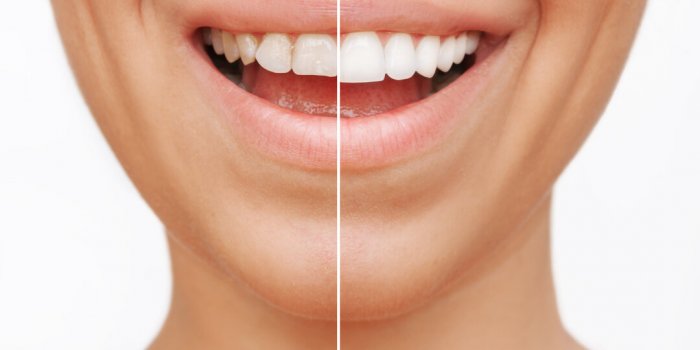 6 changements dans votre bouche qui peuvent Ãªtre le signe d'une maladie grave
