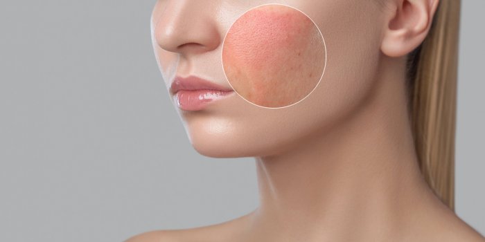Coronavirus : 8 signes Ã  repÃ©rer sur votre visage