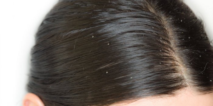 MÃ©nopause : vos hormones affectent votre chevelure 