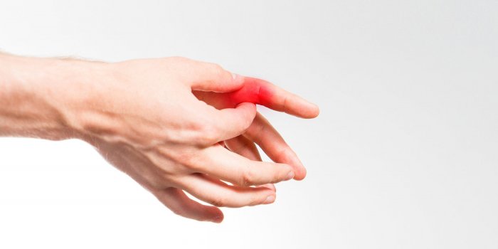 Maladie de Raynaud : les signes Ã  reconnaÃ®tre sur vos mains