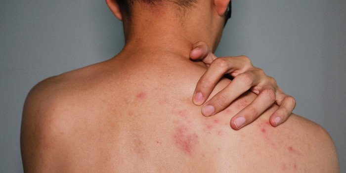 5 erreurs qui abÃ®ment la peau, selon un dermatologue