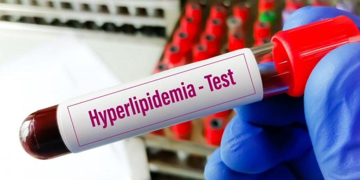 blood sample for hyperlipidemia, dyslipidemia lipid profile hypercholesterolemia