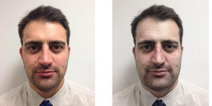 Images : A quoi ressemble le visage après 10 ans de stress