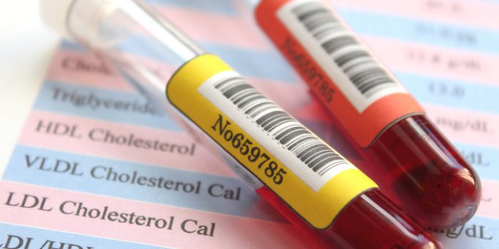 Cholestérol : 6 erreurs à ne plus faire selon le CDC