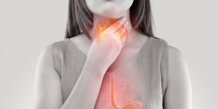 woman suffering from acid reflux or heartburn-isolated on white background