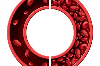 Anemie : symptomes, causes, traitements, risques et complications