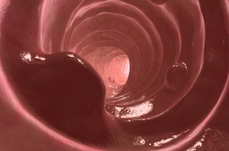 Polypes du colon et rectum (intestinaux) : symptomes, traitements, biopsie