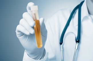 Sang dans les urines : causes et traitements d’une hematurie