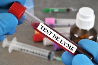 Maladie de Lyme : bientot un vaccin pour se proteger des morsures de tiques 