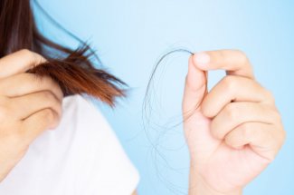 Cette pathologie des cheveux peut reveler un exces de cholesterol