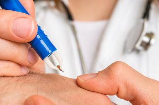 Maladie de Lyme : un vaccin prometteur, dans sa troisieme phase clinique