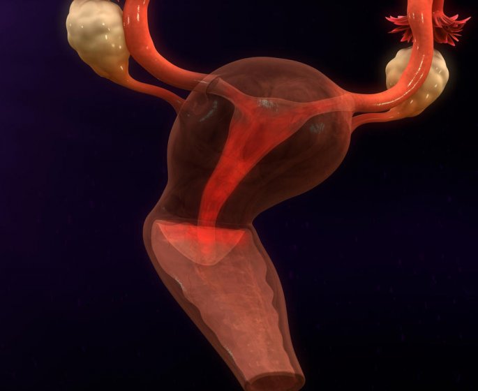 Douleurs au bas-ventre : reconnaitre une endometriose