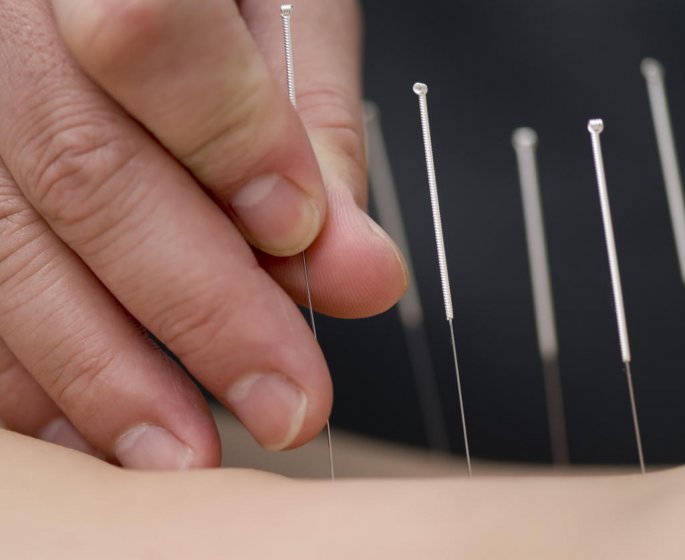 Declenchement naturel de l-accouchement : l-acupuncture efficace ?