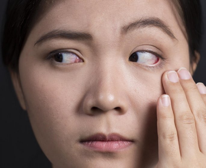 Vision trouble de l-œil gauche : une uveite en cause ?