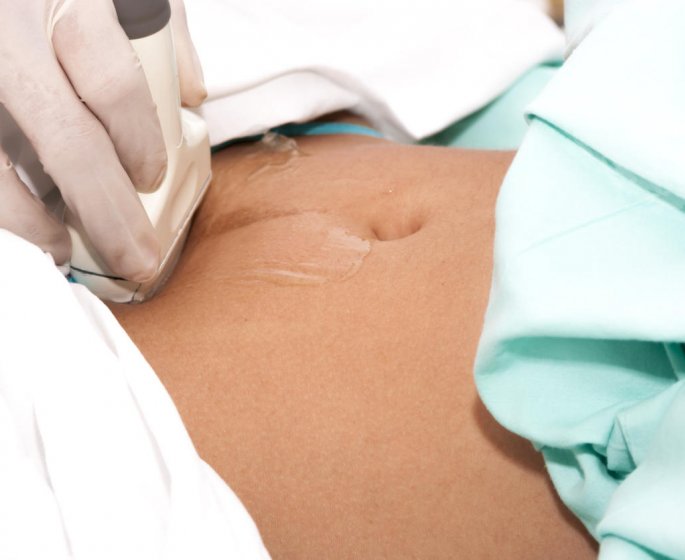 Grossesse extra-uterine : le diagnostic