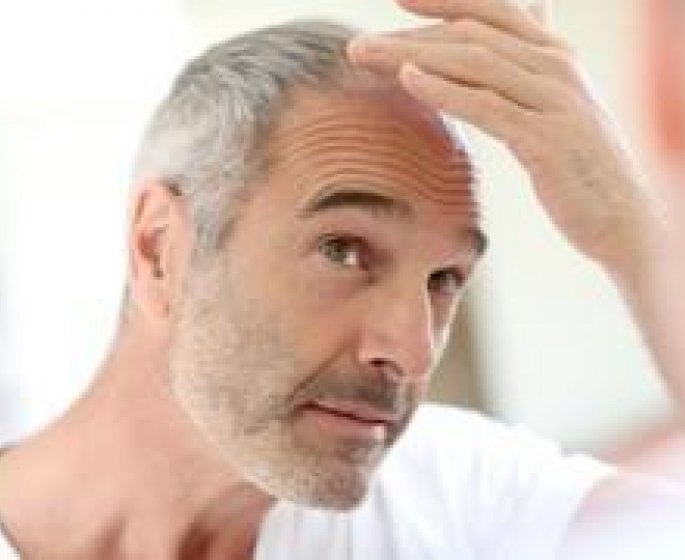 Pelade : la raison d-un blanchissement soudain des cheveux