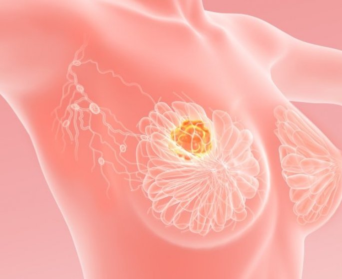 Cancer du sein : le sommeil accelere la proliferation des metastases
