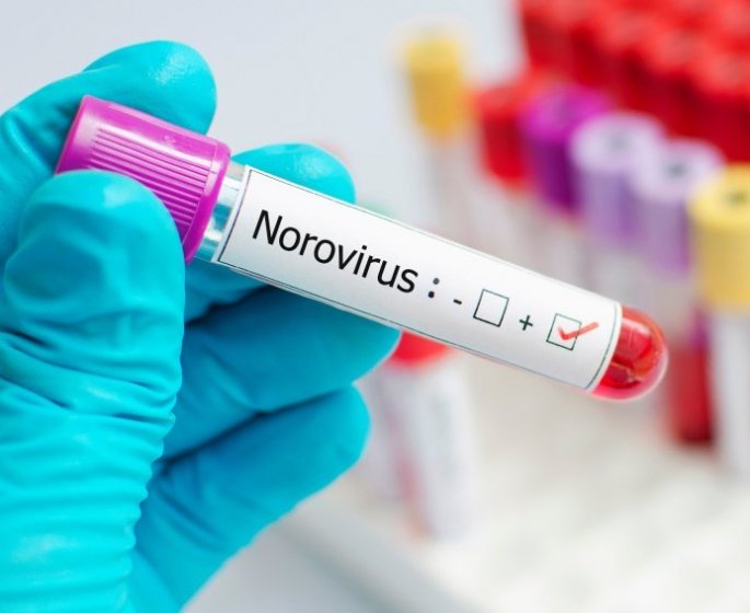 Norovirus : apres la Covid-19 une epidemie de gastro-enterite ?