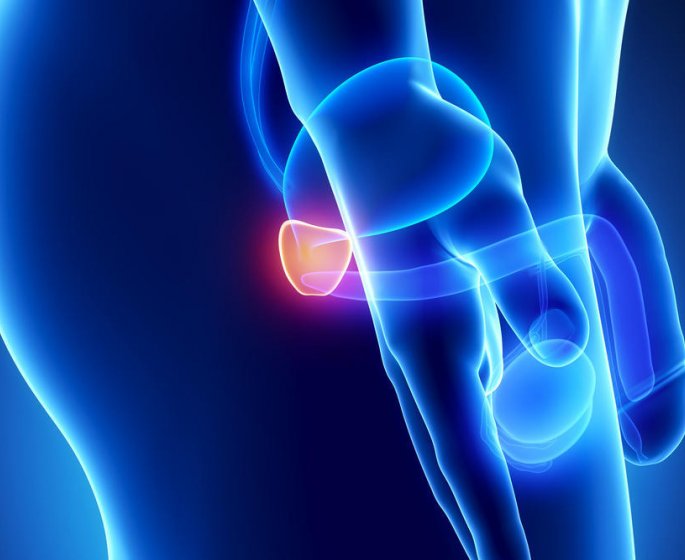 Cancer de la prostate : symptomes, causes, traitement, esperance de vie