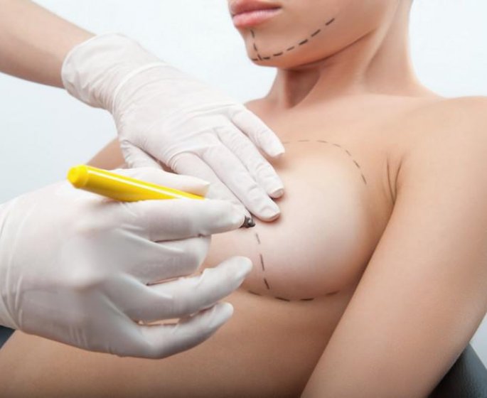 Chirurgie esthetique de la poitrine : l-augmentation mammaire