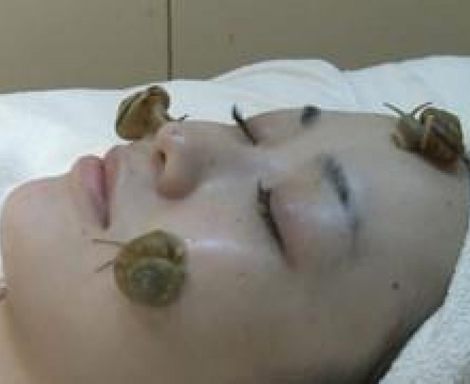 Insolite : des escargots sur la peau pour effacer les rides