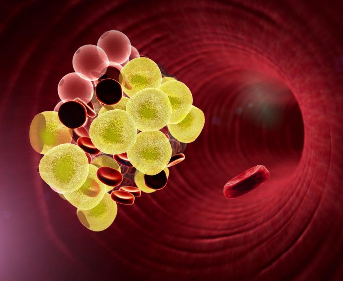 Cholesterol : un facteur de risque de thrombose
