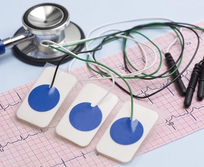 Comment voir un infarctus sur un ECG ?
